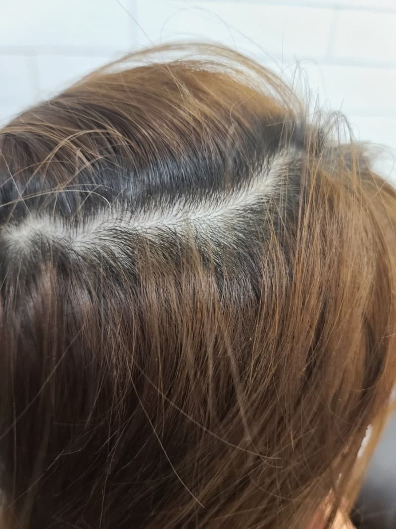 뿌리(새치)멋내기 염색 전,후 사례 1