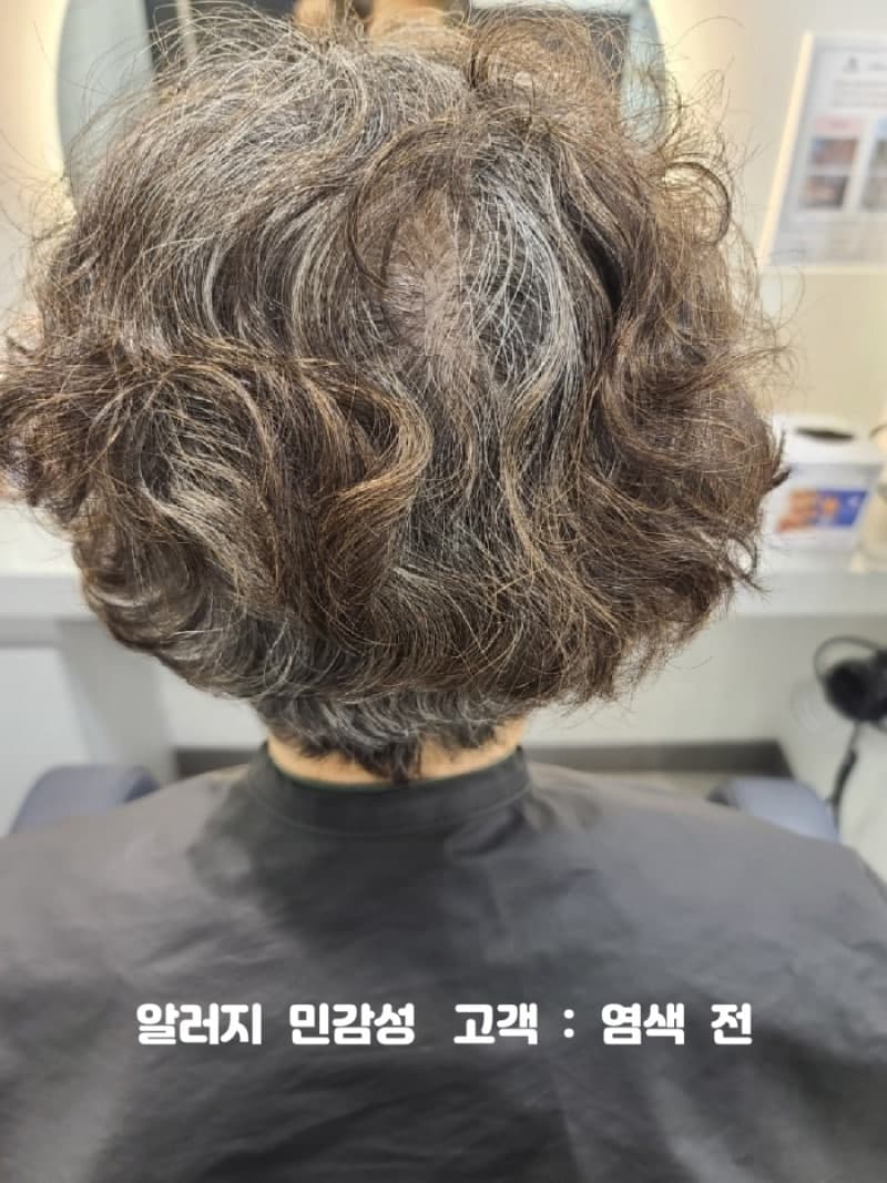알러지 두피와 염색 방법 3