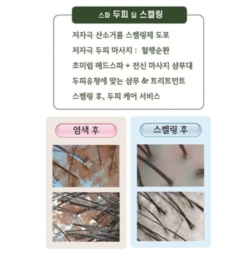 태후사랑에서 알러지 염색 후 스파모공청소로 두피관리 끝! 2
